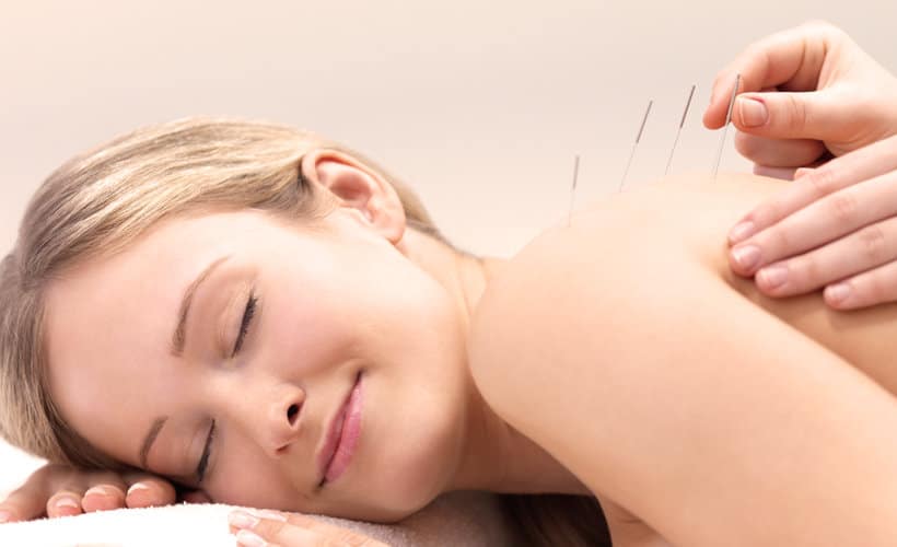5 Key Secrets to Successful Acupuncture