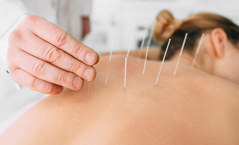 Rest, Relax & Reset: How Acupuncture Can Reset the Nervous System and Improve Fertility Outcomes