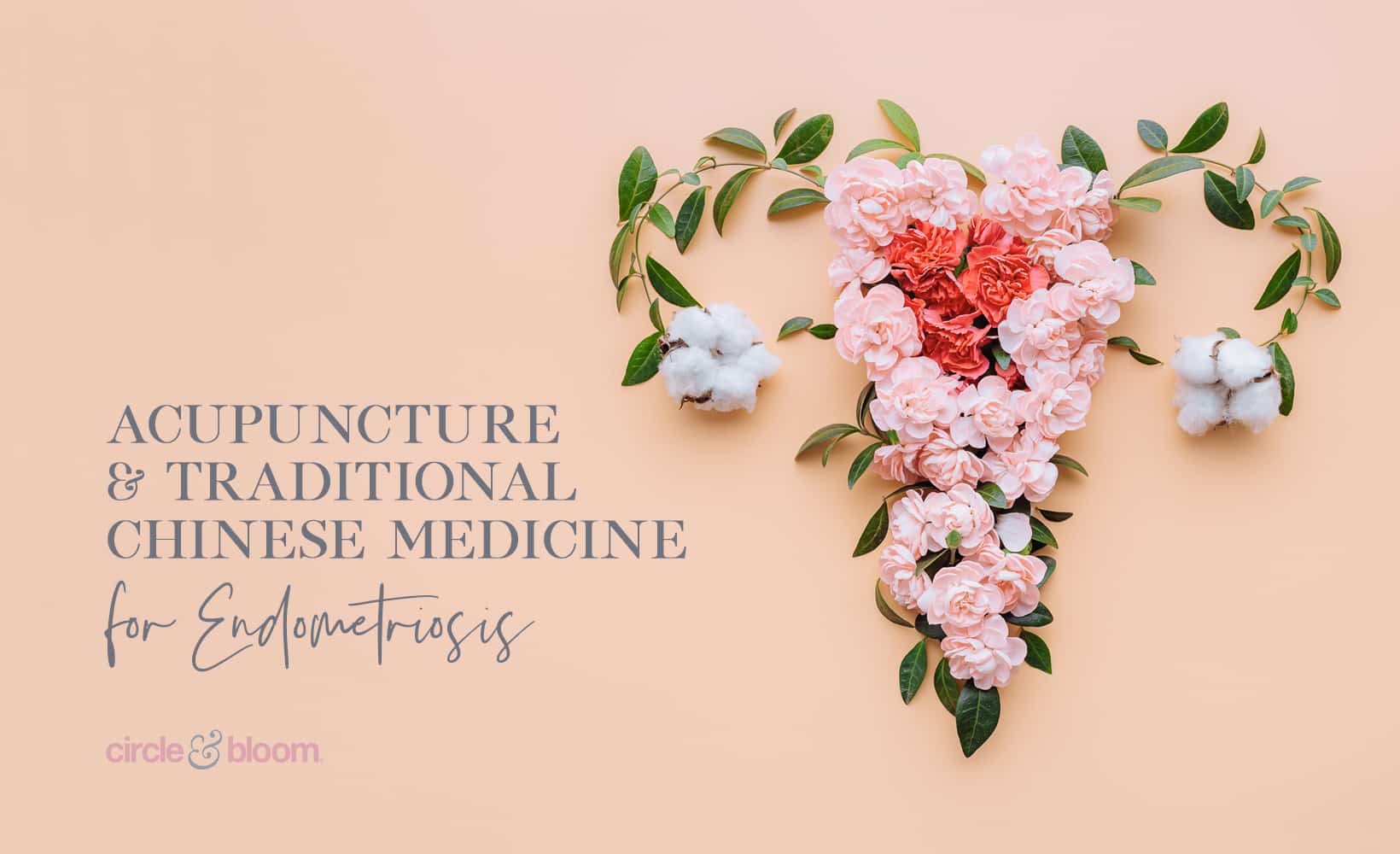 Acupuncture and Traditional Chinese Medicine for Endometriosis