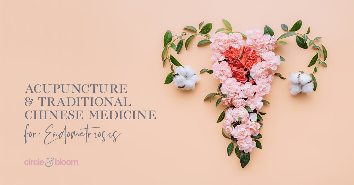 Acupuncture and Traditional Chinese Medicine for Endometriosis